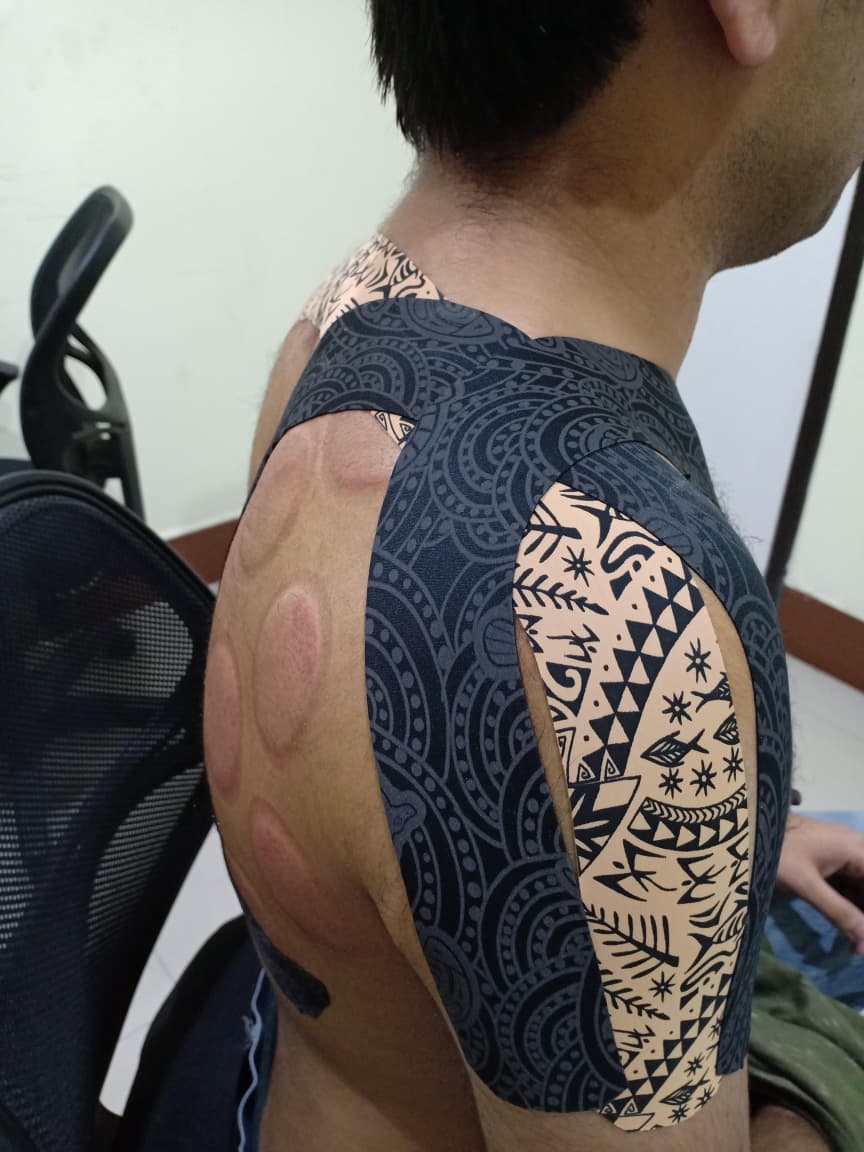 Sports Injury Rehab